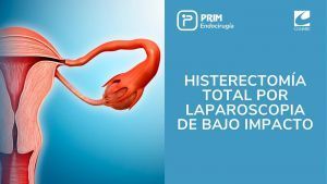 histerectomía total por laparoscopia de bajo impacto